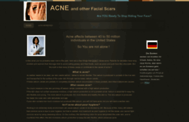 acne-skin-remedies.webs.com