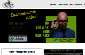 hairtransplantlahore.com