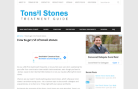 tonsilstonesadvisor.com