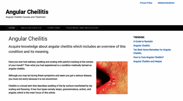 angularcheilitis.com
