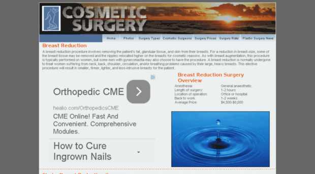 breast-reduction.cosmeticsurgeryprocedure.com