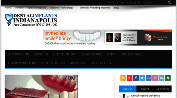 dentalimplantsindianapolis.com