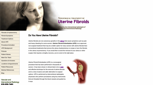 drfibroid.com