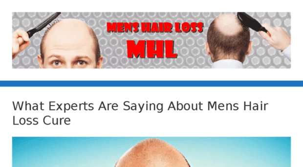 menshairloss.info