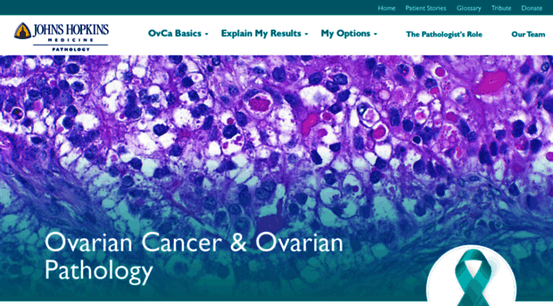 ovariancancer.jhmi.edu