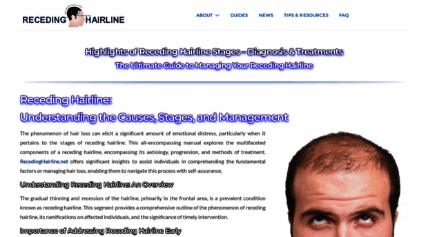 recedinghairline.net