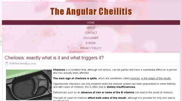 theangularcheilitis.com