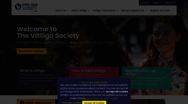 vitiligosociety.org.uk